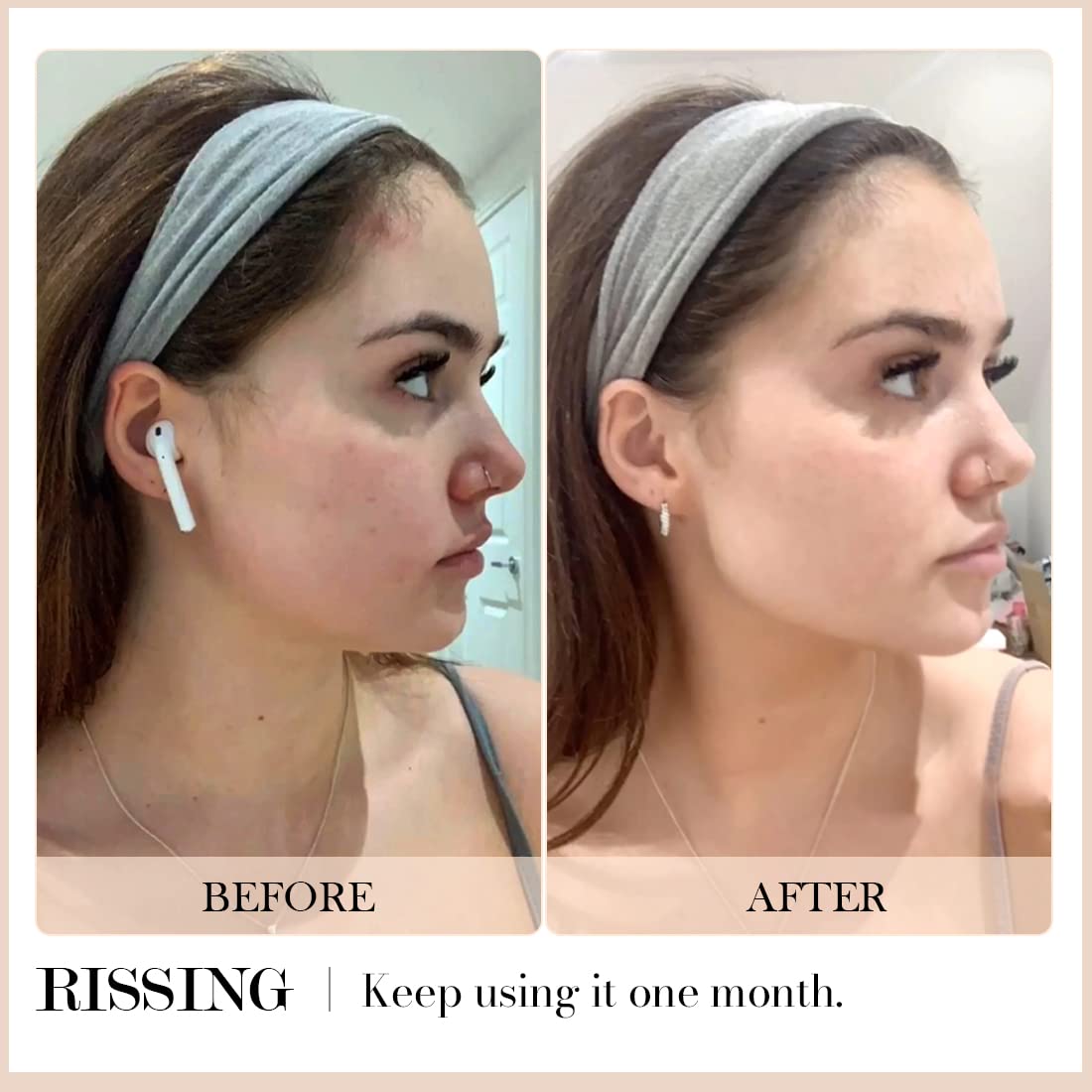 RISSING 4-in-1 Gua Sha Facial Tools: FSAHSA Eligible, Lymphatic Drainage Massager Facial Roller for Wrinkles and Lifting, Stainless Steel Gua Sha Tool for Face (Luxury Box Edition) - Image 5