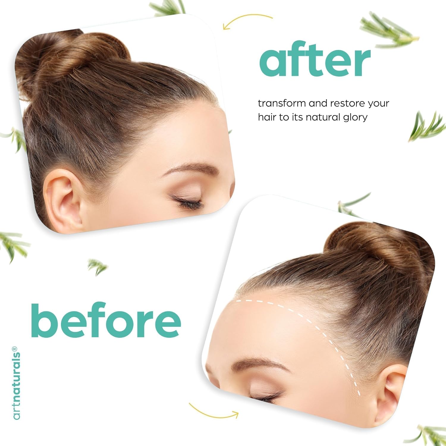 Artnaturals Organic Rosemary Castor Hair Oil + Massager Hair Growth Set Hair Growth Oil 4 ounces with Coconut & Olive Oil for Dry, Damaged & Split End - Image 6